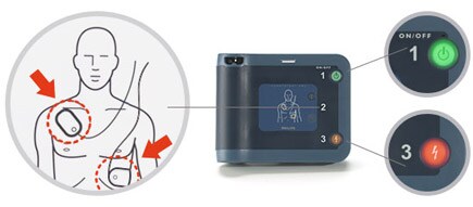 자동심장충격기(AED) 사용 가이드라인