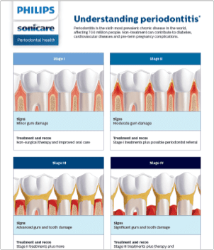 Chairside brochure image