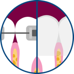 Orthodontics icon