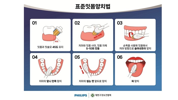 teeth to gums asset2